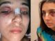 “Me decía que un demonio se le metía”: Joven denunció golpes y abuso de su ex