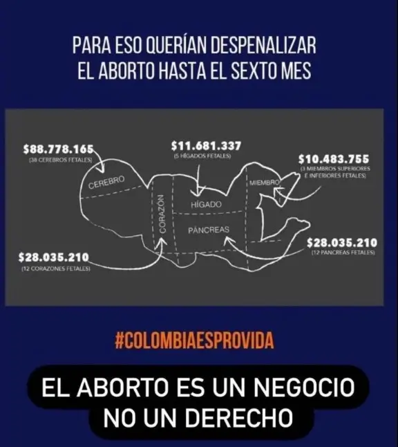 Publicacion-de-Carolina-Cruz-sobre-el-aborto