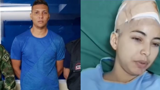 Condenado por haberle arrancado el cuero cabelludo a su pareja