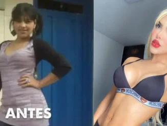 La Barbie Colombiana dio detalles de su aclaramiento de piel