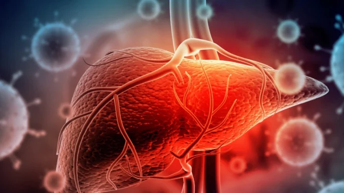 Hepatitis aguda