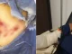 Mujer-quemada-con-polvora