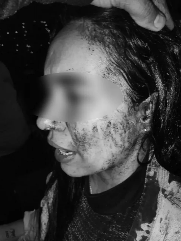 Agresion-comuna-13-1