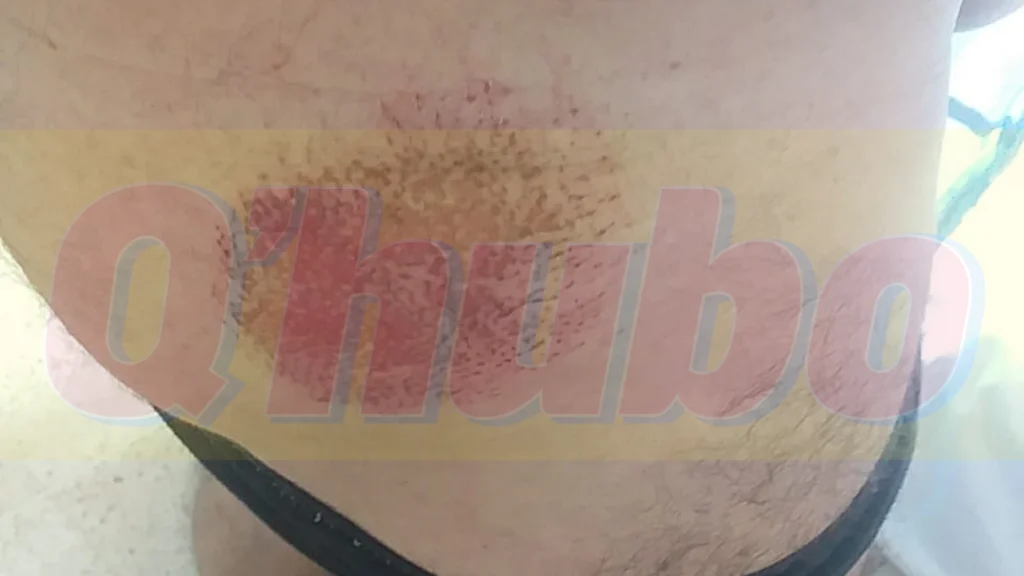 La hija de la víctima también salió lesionada.