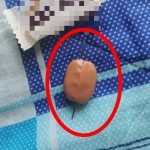 Las agujas atravesaban de lado a lado los dulces. /FOTO: Tomada de la web. 