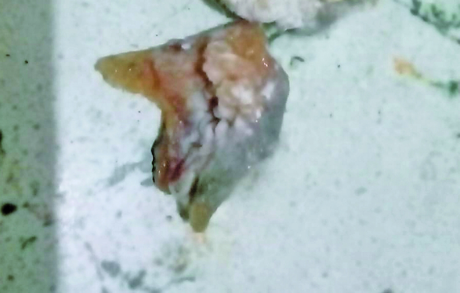 Estos fueron los chicharrones que encontraron tirados en la calle. Estaban empapados con una sustancia. / FOTO: CORTESÍA.