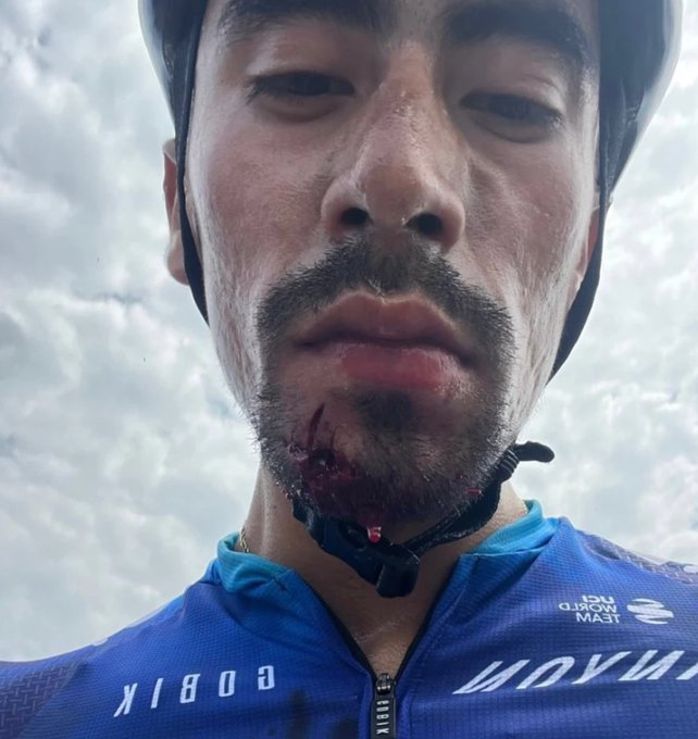 Lesión por cachazo a el ciclista Iván Ramiro Sosa.
