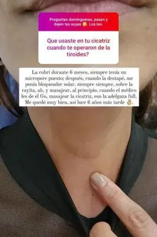 Cicatriz-Andrea-Serna