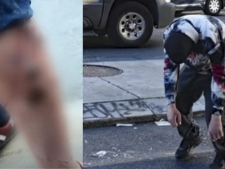 El 'tranq' es un fármaco que genera un efecto 'zombie' potente y duradero, pero con consecuencias devastadoras.