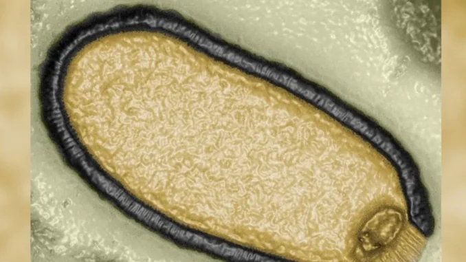 Virus, zombie, mundo, ciencia, científicos, historia, ártico, mundo curioso, internacional, Q’Hubo Medellín