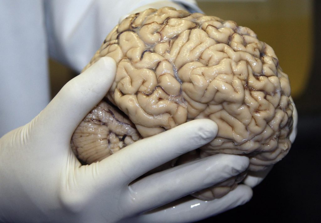 Cerebro 