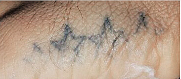 Tatuaje Medicina Legal 