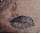 Tatuaje Medicina Legal
