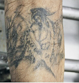 Tatuaje  Medicina Legal