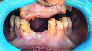 Dientes-Medicina-Legal