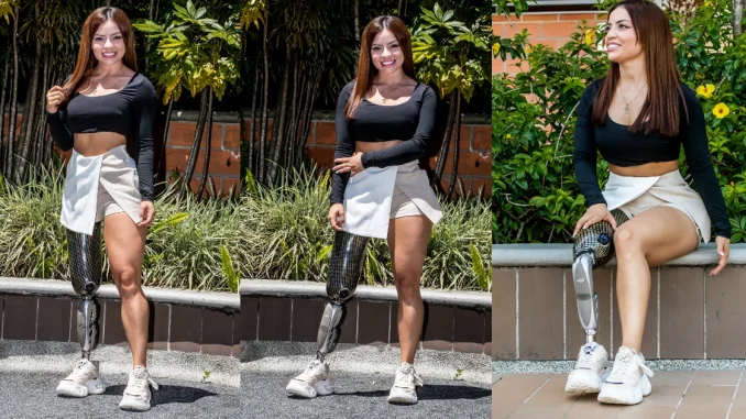 Paola Montoya modelo con prótesis