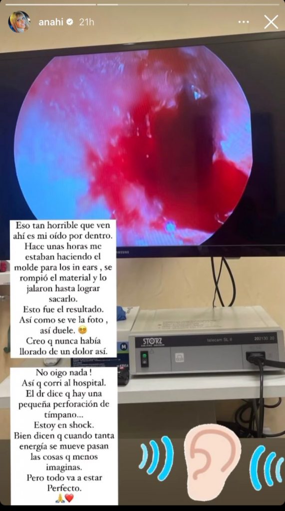 Imágenes del accidente que sufrió Anahí