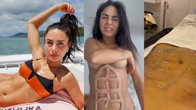 Johanna Fadul, operación, cirugía plástica, cirugía estética, viral, revuelo, actriz, fitness, entretenimiento hoy, Q’Hubo de hoy, Q’Hubo Medellín