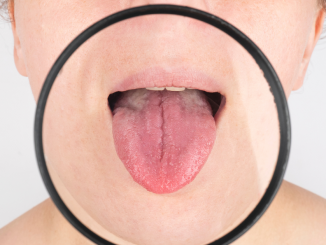 Boca lengua