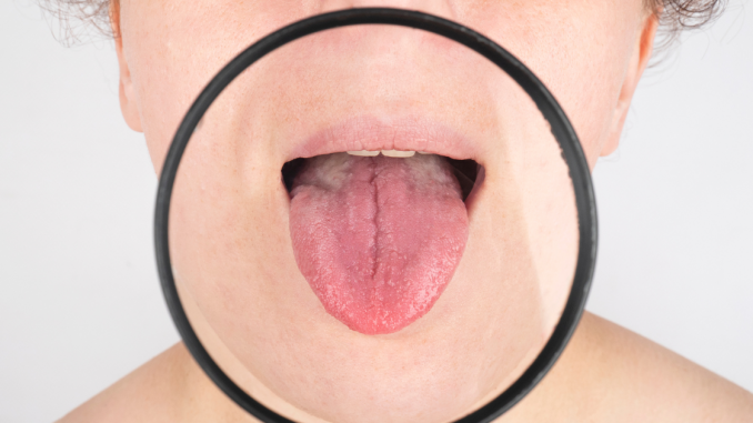 Boca lengua